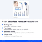 4-in-1 Blackhead Remover Vacuum Tool – Buyzo